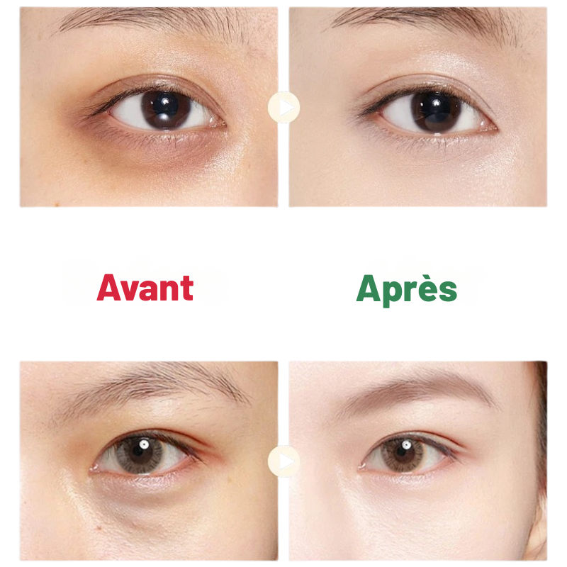 HEATING EYE - micro vibrations, thérapie lumineuse,  anti-cernes & poches