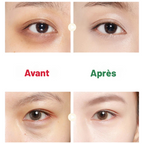 HEATING EYE - micro vibrations, thérapie lumineuse,  anti-cernes & poches